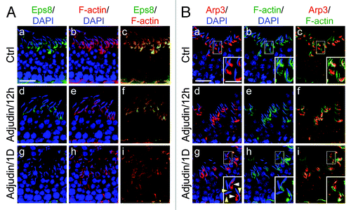 Figure 2. Adjudin disrupts the restricted temporal and spatial expression of Eps8 and Arp3 in the rat testis. Dual-labeled immunofluorescence analysis was used to assess changes in the adjudin-mediated disruption of the highly restricted spatial and temporal expression of Eps8 (green) and F-actin (red) shown in (A) vs. Arp3 (green) and F-actin shown in (B) in the seminiferous epithelium of rat testes as earlier described.Citation32,Citation33 In both (A) and (B), the control cross-sections illustrate a stage VII tubule. By 12h (hour) following adjudin treatment, a considerable loss of Eps8 was detected at the apical ES, and by 1D (day), Eps8 was virtually not detected, and this loss of Eps8, an actin bundling protein at the apical ES, was found to associate with a truncation of F-actin due to the loss of the organized actin filament bundles at the apical ES (see e-f and g-i vs. a-c in A). For Arp3, it displayed a distinctive different pattern vs. Eps8 following adjudin treatment. While both Eps8 and Arp3 were prominently expressed at the apical ES at stage VII in control rats (see a-c in B vs. a-c in A), however, Arp3 was highly restricted to the concave side of the spermatid head where endocytic vesicle-mediated protein trafficking is known to occur.Citation40 By 12h following adjudin treatment, Arp3 became mis-localized and this mis-localization was more obvious by 1D after adjudin treatment. For instance, by 1D, Arp3 was found to become truncated (see “white” arrowheads in the enlarged inset in B:g). Additionally, Arp3 was also found to be mis-localized, surrounding other parts of the spermatid head, instead of restricted to the concave side of the spermatid head (see “yellow” arrowheads in the enlarged inset in B:g). Thus, the actin filament bundles at the apical ES were transformed to a branched network because Arp3 induces actin nucleation/branching. The combined changes of these two actin regulatory proteins induced by adjudin thus led to the degeneration of the actin filament bundles at the apical ES. These changes coupled with changes in drebrin E, PAR6 and 14–3-3 as described in the main text destabilizes the apical ES, rendering a loss of adhesion at the apical ES which led to spermatid loss from the epithelium. Bar in A:a or B:a = 40 μm, which applies to b-i in A or B; bar in inset in B:a = 20 μm, which applies to insets in b-c and g-i.