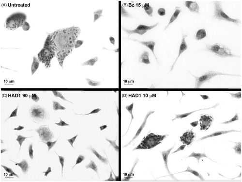 Figure 7. Light microscopy images of T. cruzi-infected macrophage cultures treated with HAD1. The cultures were treated 24 h after the establishment of T. cruzi infection. (A) General aspect of macrophages cultures after 72 h of infection by T. cruzi. (B) Clearance of intracellular parasites after 72 h treatment with 15 µM of benznidazole. Note the effectiveness of HAD1 compound against amastigotes after 72 h of treatment with 90 µM (C) and 10 µM (D).