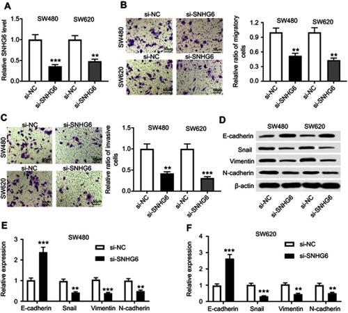 Figure 2 The effect of SNHG6 knockdown on the migration, invasion, and EMT of CRC cells. SW480 and SW620 cells were transfected with si-NC or si-SNHG6. (A) SNHG6 expression was detected by qRT-PCR in transfected cells. (B–C) Transfected cell migration and invasion capacities were assessed by transwell assays. (D–F) Western blot analysis was used to observe the levels of E-cadherin, Snail, Vimentin, and N-cadherin in transfected cells. **P<0.01 or ***P<0.001 vs si-NC.