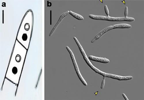 Figure 1. Vegetative growth forms of Zymoseptoria tritici. (a) Mycelium contains pair of nuclei. (b) the arrow indicates lateral budding of macropycnidiospores to form a single cell.