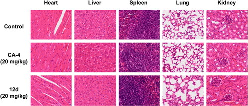 Figure 11. Representative images of H&E-stained vital organ, including heart, liver, spleen, lung and kidney. Scale bar = 20 µm.