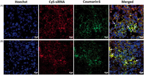 Figure 5. In vivo co-delivery study. Confocal laser scanning microscopy images of tumour frozen sections from sacrificed mice after intravenous injection of Cy5-siRNA/coumarin-6 co-loaded cationic liposomes (A) and CMCS modified Cy5-siRNA/coumarin-6 co-loaded liposomes (B).