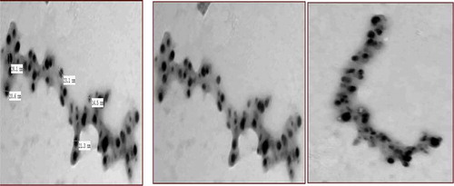 Figure 9. TEM image clarify the diffusion of seed-protected AgNPs to L-(+)-lysine functional groups (2 ml 200μg/ml of seed-AgNPs in 80 mg L-lysine:10 ml water).