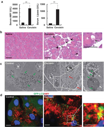 Figure 1. Cerulein induces pancreatitis in mice. Pancreatitis was induced by 7 hourly intraperitoneal injections of cerulein (50 μg/kg) in male C57BL/6J mice. (a) Serum AMY and lipase levels were measured. Data shown are mean ± SE (n = 4). **p < 0.01 by Student t test. (b) Representative H&E staining images of mouse pancreas from cerulein treatment. Right panel was an enlarged photograph from the indicated boxed area. Arrows denote vacuolized acinar cells. Arrow heads denote infiltrated inflammatory cells. Omega denotes edema. Bar: 50 μm. (c) Representative EM images from saline and cerulein-treated mouse pancreas. N: nucleus. White arrows: large autolysosomes. Green arrows: zymogen granule. Red arrows: aberrant ER membranes. Bar: 2 µm. (d) Male GFP-LC3 transgenic mice were administrated with 7 hourly intraperitoneal injections of cerulein (50 μg/kg). Cryo-sections of pancreas were subjected to immunostaining for AMY (red) and nuclei were stained with Hoechst33342 followed by confocal microscopy. Arrows denote the co-localization of GFP-LC3 (green) and AMY. Bar: 10 µm.