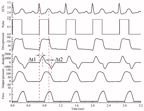 Figure 4. The timing relationship between ECG and aortic pressure and flow tested in MCS.
