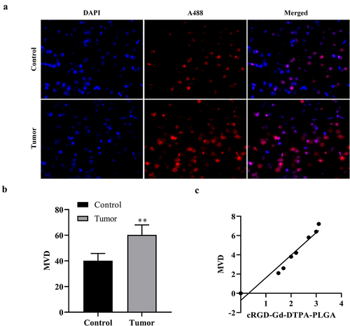 Figure 7. Correlation analysis between signal-to-noise ratio of MRI and microvessel density (MVD).