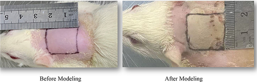 Figure 1 Images comparing the skin tissue before and after modeling.