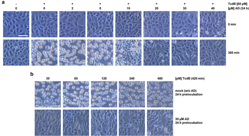 Figure 1. Effect of 24 h amiodarone preincubation on the intoxication of Vero cells by TcdB. (a) Vero cells were preincubated for 24 h with increasing concentrations of amiodarone (AD) as indicated, prior to addition of 60 pM TcdB (+ TcdB). Control cells were left without toxin treatment (− TcdB). Shown are microscopic images from time points 0 (upper row) and 360 min (lower row) after TcdB addition. (b) microscopic images from Vero cells preincubated for 24 h either without amiodarone (mock; w/o AD; upper row) or with 30 µM amiodarone (30 µM AD; lower row), followed by the intoxication of the cells for 420 min with increasing concentrations of TcdB as indicated. Scale bar shown in (a) and (b) represents 100 µm.