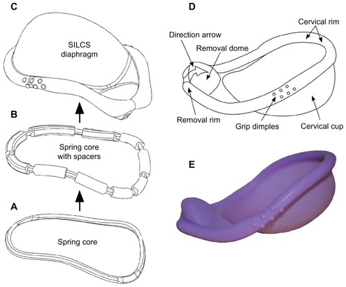 Figure 5 The SILCS diaphragm. (A) The thermoplastic spring core consists of nylon-6 in the original SILCS device and polyoxymethylene in the dapivirine-releasing device. (B) Spring core with over-molded silicone elastomer spacers, for positioning the spring core within the injection molds during the final overmolding step. (C) Finished diaphragm device, formed by overmolding the spring core + spacers with silicone elastomer. (D) Design features of the SILCS diaphragm. (E) Photograph of the SILCS diaphragm.