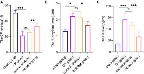 Figure 5 Knockdown of miR-130a-3p not only improves pancreatic endocrine and exocrine functions but also protects endothelial cells. (A) ELISA detection of C-peptide in serum from mice in each group. (B) ELISA detection of hyaluronic acid (HA) in serum from mice in each group. (C) DNS method for calculation of the β-amylase activity in serum from mice in each group (***p <0.001, **p <0.01, *p <0.05, NS denotes no significant difference).