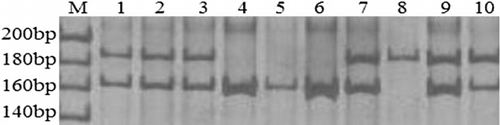 Figure 1. PCR products for 12 bp in-del polymorphisms.Note: M, DNA marker; Lane 1, 2, 3, 7, 9 and 10 for +−; 8 for ++; 4, 5 and 6 for −− genotypes.