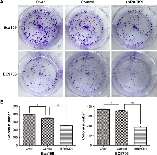 Figure 2 RACK1 regulated cell colony formation ability of ESCC cells in vitro.