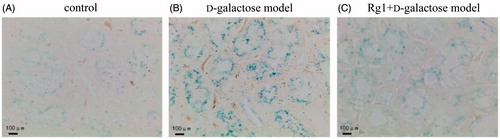 Figure 3. Effect of Rg1 on the kidney cells senescence of d-galactose model mice (SA-β-Gal stain × 400).