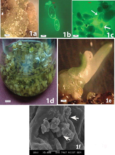 Figure 1. (a) Calli forming from male immature banana flowers. (b) Round or oval-shaped viable single cells observed during the initial stages of cell suspension. (c) Formation of somatic embryos at various stages of development. (d) Culture in liquid medium containing globular somatic embryos. (e) Green shoot development from the embryo. (f) Secondary somatic embryos appearing as small protuberances on the surface of primary somatic embryos