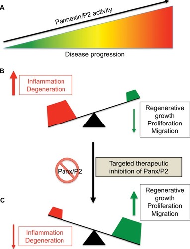 Figure 5 Effect of therapeutic suppression of pannexin function.Notes: (A) Disease progression often correlates with increased Panx/P2-receptor activity and chronic inflammation (B). We hypothesize that therapeutic suppression of pannexin function may tilt the balance of a progressing disease from that of inflammation and degeneration to one of enhanced cellular growth, proliferation, and/or migration (C).