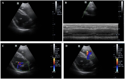 Figure 2. Echocardiogram of a horse. (A) Two dimensions of the echocardiogram were obtained from the right parasternal window. (B) M-mode echocardiogram, (C) The colour flow Doppler echocardiogram of the mitral valve (MV), (D) The colour flow Doppler echocardiogram of the tricuspid valve (TV)
