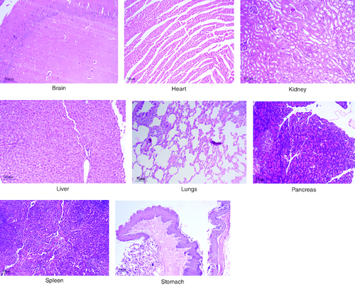 Figure 8. Represent the micrograph of the various vital organs from the group consuming 2000 mg/kg of PHF tablet.