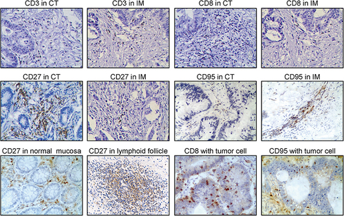 Figure 1 Representative IHC staining of CD3, CD8, CD27, and CD95 in the core of the tumor (CT) and in the tumor’s invasive margin (IM) in colon tumor tissue and in normal colon tissue (100×).
