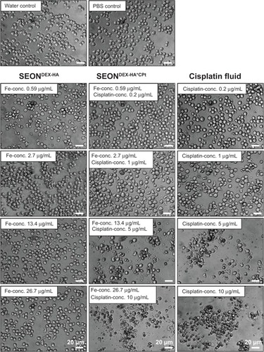 Figure 12 Light microscope images of Jurkat cells after 30 hours of treatment with cisplatin fluid.Notes: SEONDEX-HA*CPt, and SEONDEX-HA. SEONDEX-HA without the drug did not induce cell death, whereas cisplatin fluid and SEONDEX-HA*CPt with cisplatin concentration from 1 μg/mL onwards induced blebbing and shredding of the plasma membrane in a dose-dependent manner.Abbreviations: PBS, phosphate-buffered saline; SEONDEX, dextran-coated SPIONs; SPIONs, superparamagnetic iron oxide nanoparticles; CPt, cisplatin; HA, hyaluronic acid; conc., concentration.