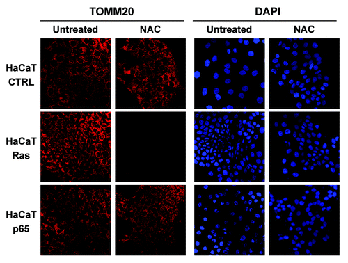 Figure 12. Antioxidant treatment selectively inhibits mitochondrial biogenesis in Ras-transformed epithelial cancer cells. HaCaT epithelial cells (control, H-Ras [G12V], or NFkB [p65]) were cultured alone (in the absence or presence of NAC [10 mM]) and then subjected to immunostaining with TOMM20, a marker of mitochondrial mass. Note that HaCaT-Ras cells show the most significant increase in mitochondrial mass, and that this is strictly dependent on oxidative stress. DAPI (blue nuclear staining) is also shown for reference.