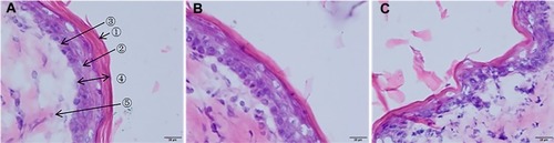 Figure 7 Histological photomicrographs of frozen section taken from rabbit treated with various applications (× 400).Notes: Saline (A); ASI-NEs (B); ASI-NBGs (C); ①stratum corneum; ②stratum spinosum; ③ stratum basale; ④ epidermis; ⑤dermis.Abbreviations: ASI-NEs, asiaticoside-loaded nanoemulsions; ASI-NBGs, asiaticoside-loaded nanoemulsions-based gels.