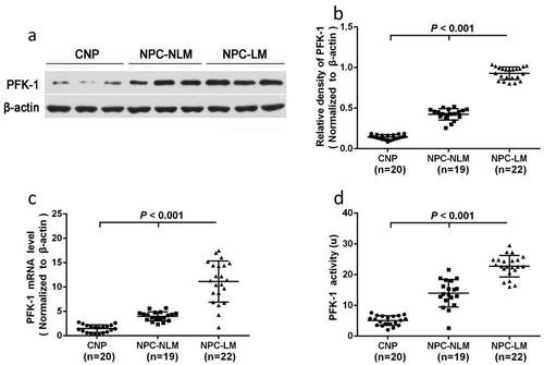 Figure 1. Expression and activity of PFK1 in nasopharyngeal tissues. (a–b) Western blot of PFK1 in different tissues where β-actin protein was used as reference shows significant difference in PFK1 expression level. (c) Quantification of PFK1 mRNA expression in different nasopharyngeal tissues detected by qPCR. The expression of β-actin protein and mRNA was served as the controls for sample loading. (d) Analysis activity of PFK1 enzyme in different groups. All experiments were performed at least three times with consistent and repeatable results