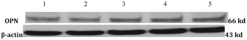 Figure 3. Detection of osteogenic indices by Western blot. 1: Control group; 2: Ad-null group; 3: Ad-VEGF165 group; 4: Ad-BMP2 group; 5: Ad-VEGF165 + Ad-BMP2 group.