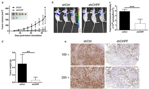 Figure 6. CHPF knockdown inhibited tumor growth of cholangiocarcinoma in vivo.