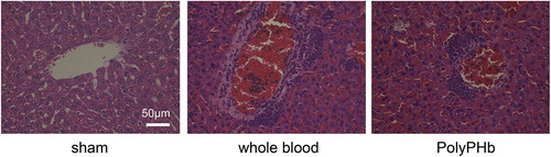 Figure 4. Representative photomicrographs of HE-stained hepatic tissue sections (n = 5). Original magnification × 400; scale bar: 50 μm.