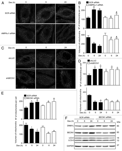 Figure 5. Mitochondria morphology shown by confocal microscopy in SCR and AMPKα1 knockdown L6 myotubes incubated with Dex for 0, 6, and 24 h (A). Quantification of mitochondrial volume and number per cell presented in (A). (B) Mitochondria morphology shown by confocal microscopy in LUC and BECN1 knockout L6 myotubes incubated with Dex for 0, 6, and 24 h (C). Quantification of mitochondrial volume and number per cell presented in (C). (D) Quantification of mitochondrial volume and number per cell in SCR and BECN1 knockdown L6 myotubes incubated with Dex for 0, 6, and 24 h (E). Western blot analysis of DNM1L, BECN1, LC3, and GAPDH in SCR and BECN1 knockdown L6 myotubes incubated with Dex for 0, 6, and 24 h (F). Data: mean ± SEM of at least 3 independent experiments. Statistically significant differences were calculated using ANOVA in combination with a Tukey test for group comparison. *P < 0.05 vs. time 0 (SCR siRNA). #P < 0.05 vs. SCR siRNA + Dex.