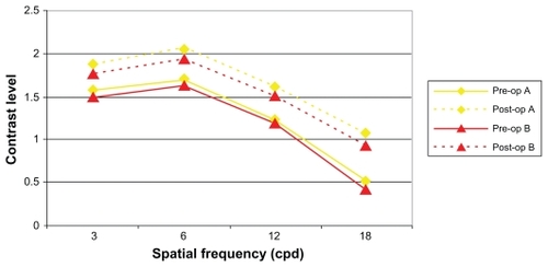 Figure 9 Contrast sensitivity shows no significant difference between groups A and B either preoperatively (pre-op) or postoperatively (post-op).