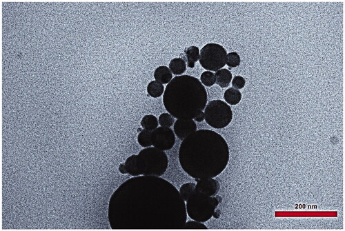 Figure 1. TEM micrographs of KA-SLN (KA-SLN3).