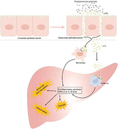 Figure 3. Porphyromonas gingivalis Derivates promote pro-inflammatory mediators leading to intracellular lipid accumulation and inflammatory reaction.