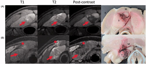 Figure 2. Post treatment MR (T1, T2 STIR, and T1 post-contrast) and gross pathology images from two experimental animals. Row A demonstrates observed histotripsy treatment changes including T2 hypointensity and non-enhancement of the treatment zone (arrow), with a rim of T2 hyperintensity around the treatment. Areas of intrinsic T1 intensity are likely due to blood products. Row B shows mild T2 intense edema (asterisk) and evidence of treatment effect in the overlying muscle (M). Gross images show treatment effects within the targeted thymus tissue (T). Note the diminutive thyroid gland (Th) deep to the thymus (T). Measurements were completed on MR images in anteroposterior, transverse, and craniocaudal dimensions.