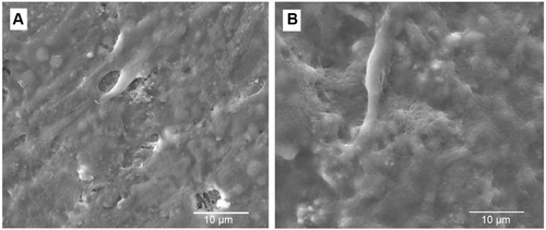 Figure S3 Scanning electron microscope images of osteoblast-like cells on the surfaces of the control and group 2 samples cultured for 14 days.Notes: (A) Control group; (B) group 2.