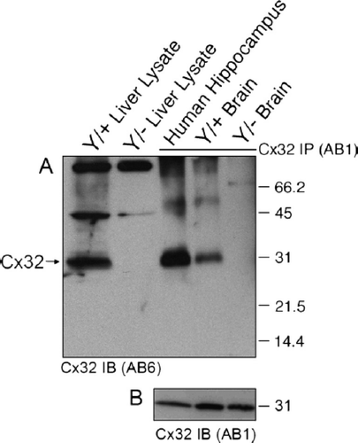 Figure 6. Brain-specific cross-reactivity is not observed following immunoprecipitation. (A) Cx32 lysates were purified from native RIPA lysates using monoclonal AB1, resolved under denaturing conditions by SDS-PAGE, and immunoblotted using polyclonal AB6. In the first two lanes WT (Cx32Y/×) and null-mutant (Cx32Y/−) liver lysates were subjected to Western analysis under reducing/denaturing conditions. The following three lanes represent human hippocampus and murine brain samples from WT (Cx32Y/+) and null-mutant (Cx32Y/−) controls immunoprecipitated with AB1 under native conditions before denaturing/reducing SDS-PAGE separation and immunoblotting with AB6. Specific immunoaffinity purification of Cx32 is observed under these conditions. (B) Standard Western analysis with aliquots of the same samples used in (A) reiterate the cross-reactivity observed when protein is first detected under reducing/denaturing conditions.