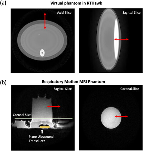 Figure 2. MR magnitude images of (a) virtual simulation phantom and (b) respiratory motion phantom in the MRI scanner. An ultrasound transducer was set up to heat a tissue-mimicking phantom, while the motion simulator can only move the phantom. The red arrow indicates the motion direction induced by the respiratory motion.