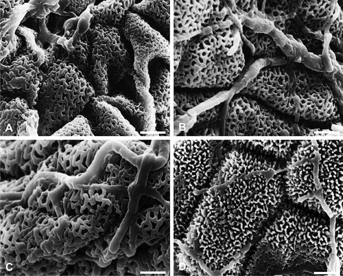 Figure 2. Details of massulae and elastoviscine threads in Habenaria species. A–C. Ramified elastoviscin, apparently hollow threads in: A. H. paucifolia; B. H. bractescens (elastoviscin threads showing pores); C. H. secunda. D. Massula of H. gourlieana, viscous elastoviscin threads and pollenkit-like substance on massulae. Scale bars – 5 μm (A–D).