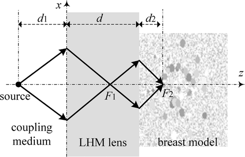 Figure 1. Focusing of flat LHM lens in the breast model.