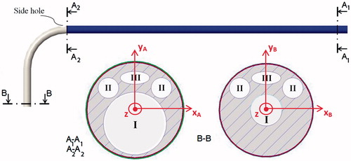 Figure 8. Possible cross-sectional views ('A1-A1, ' 'A2-A2, ' and 'B-B') at positions A1, A2, and B, of a design A catheter. Four lumens are shown: a central operative lumen (I) for the guidewire tipped laser fiber and the 'stabilizer', two lumens for EM sensors (II), and a lumen for the steering cable (III). The cross section A1-A1 is constant in the catheter blue portion. Then, after the side hole for the 'stabilizer, ' tapering of the central operative lumen (I) as well as the catheter external diameter was started. Two coordinate systems (XAYAZ and XBYBZ, respectively) used for calculation of the second moment of area (Ixx, Iyy, Jzz) at 'A1-A1' and 'B-B' are represented.