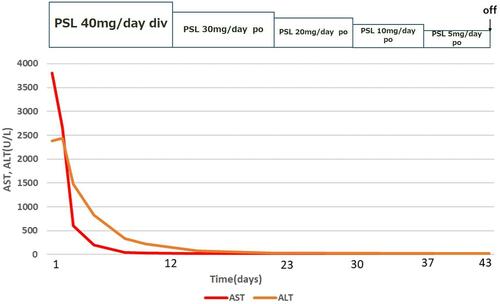 Figure 3 Clinical course of the patient. Decreases in AST and ALT were observed after the administration of steroids.