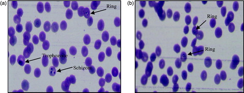 Figure 5. Photographs showing in vitro antimalarial activity of the most active compound, 3′l against (a) CQ-sensitive 3D7 and (b) CQ-resistant RKL9 strains of P. falciparum.