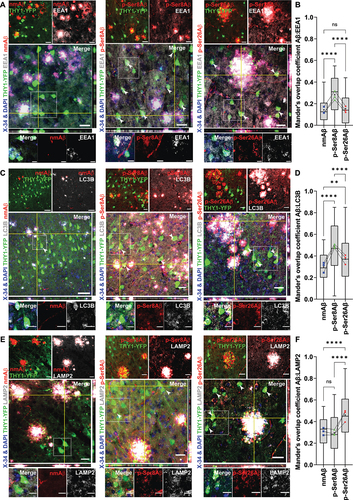 Figure 2. Differential intraneuronal colocalization of pAβ with vesicular marker proteins in APP-PSEN1dE9 transgenic mice. (A, C, E) Immunohistochemistry depicting differential intraneuronal colocalization of Aβ species in brain sections of APP-PSEN1dE9×THY1-YFP transgenic mouse cortex (7.3 m, female) stained with different phosphorylation-state specific Aβ antibodies (nmAβ-7H3D6, p-Ser8Aβ-1E4E11 and p-Ser26Aβ-5H11C10; red channels respectively) along with antibodies against EEA1 (gray, A); LC3 (gray, C) and LAMP2 (gray, E) and DAPI + X-34 (nuclei and plaque core, blue). Scale bar: 50 µm; zoomed panels, 10 µm. White arrowheads indicate colocalized punctate staining between red and gray channels in THY1-YFP-positive neurons. Source data have been provided in figure S8B-D. (B, D, F) Mander’s coefficient of overlap between red channels (npAβ, blue; p-Ser8Aβ, green and p-Ser26Aβ, red data points) with respect to gray channels (EEA1, B; LC3, D and LAMP2, F), quantified within THY1-YFP-positive neurons respectively. Box plot depicts the overall distribution of data, and each data point represents average values from an individual mouse, N = 3 transgenic mice. ns > 0.05; *p = 0.05; **p = 0.01; ***p = 0.001; ****p = 0.0001 (One-way ANOVA, GraphPad Prism). Additional staining and antibody control experiments are provided in figure S2.