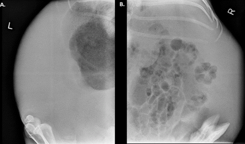 Figure 2. Abdominal radiographs. Loss of serosal detail in the abdomen confirms the presence of peritoneal free fluid.