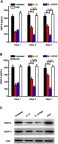 Figure 3 Measurement of cytokines VEGF-A and MMP-9 in rat endothelial cells after in vitro treatment. Cells were treated with IL-12 or IL-12-PNP at an equivalent concentration of 5 ng mL−1 IL-12 for 24 h. Saline-treated cells were negative controls. Fresh medium was added to the cells and they were incubated at 37°C. After various time intervals, the cytokines in the supernatant were analyzed by ELISA (A and B). One-way ANOVA and Newman-Keuls post-hoc test were used to determine differences among ≥3 groups. *P<0.05; **P<0.05. Data are mean ± SD (n=3). On day 7, cellular protein was extracted for Western blot analysis (C). Representative Western blot from three independent experiments.