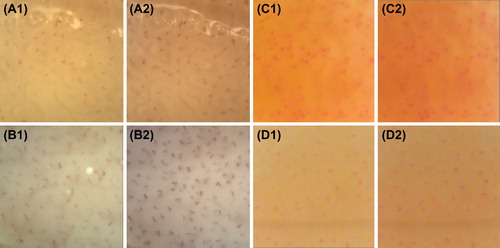 Figure 1. Representative images of baseline (Citation1) and total (after venous congestion) (Citation2) capillary density (BCD and TCD, respectively) in the dorsum of the fourth finger of the non-dominant hand in normotensive lean subject (panel A), in hypertensive lean patient (panel B), and normotensive and hypertensive obese patients before weight reduction (panel C and D, respectively).