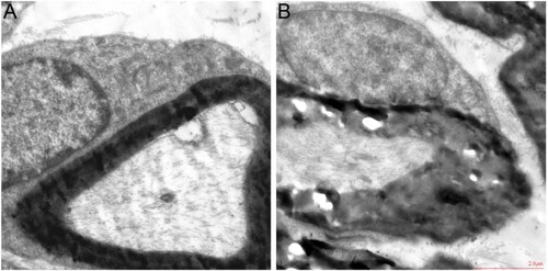 Figure 7. TEM of SCN of mice (A) control group, (B) model group. Magnification × 3000, scale bar = 2 μm. TEM: transmission electron microscope.