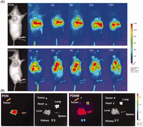 Figure 6. In vivo NIR fluorescence imaging of DiR-labeled PDN and PDNM. (A) In vivo imaging of 4T1 cancer-bearing BALB/c mice receiving a single injection of PDN or PDNM, respectively. The dashed black circles indicate the tumor burden. (B) Ex vivo imaging of tumor and organs excised from 4T1 tumor-bearing mice 24 h post injections of the two fluorescent formulations. Compared to PDN, the PDNM showed higher drug distributions at tumor site. The yellow arrows point to the tumor tissue.