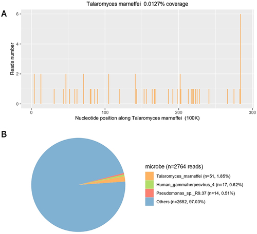 Figure 2 Confirmation of TM specific amplification from lung tissue by NGS. (A) The reads mapped to TM derived from NGS data. A total of 51 reads were mapped to TM in the reference database, which contains approximately 2764 pathogen genomes and has a total coverage of 0.0127%. (B) The distribution of microbe sequences (N = 2764 reads) identified in patient plasma, including TM (N = 51; 1.85%), human gammaherpesvirus 4, Pseudomonas sp.R9.37 and others.