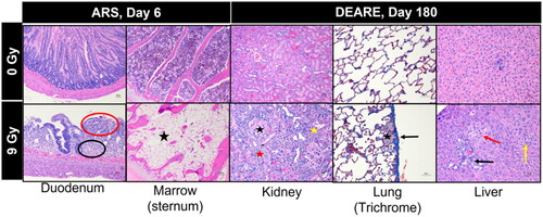Figure 6. Representative histology of ARS and DEARE. GI- and H- ARS findings (9 Gy) indicate duodenal degeneration of crypts (small circle) and villi (large circle), marrow shows marked decrease in BM cellularity (star). DEARE-associated findings in kidney reveal glomerulosclerosis (upper left star), tubular degeneration/regeneration (upper right star) and tubular changes consistent with chronic progressive nephropathy (lower left star). Lung findings indicate focal pleural fibrosis (arrow) and a focal increase in alveolar macrophages (star). Liver findings are of biliary hyperplasia (lower left arrow), eosinophilic (right arrow) and clear cell (upper left arrow) focus.